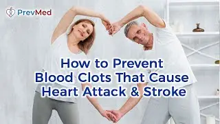 How to Prevent Blood Clots That Cause Heart Attack & Stroke