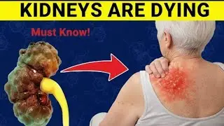 9 Warning Signs Your Kidneys Are Failing &mdash; Tests That Can Help You Avoid Dialysis