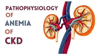 pathophysiology of Anemia of CKD