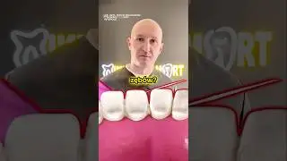 Czy Irygator Zastąpi Nitkowanie Zęb&oacute;w? 🤔