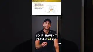How To Place a 12-Lead EKG