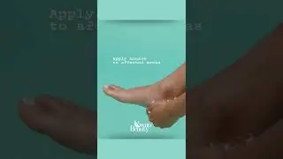 Heal Cracked Heels with Footlogix