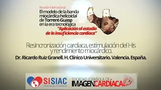 Resincronización cardiaca, estimulación del His y rendimiento miocárdico.