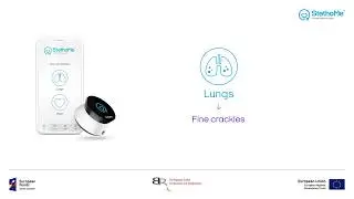 Lungs auscultation fine - crackles #2