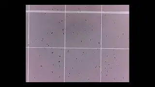 Use of a hemocytometer