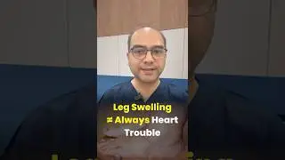 Swollen Ankles? It&rsquo;s Not Always Your Heart! | Venous Edema vs Heart Failure Explained #swollenankles