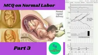 MCQ on Normal Labor Part 3 important point....