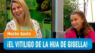 Gisella Gallardo y su hija Matilda nos hablan del vitiligo que padecen