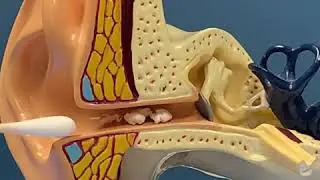 Dr  Aaron Rogers talks EAR WAX ! #cerumen_removal #earwax