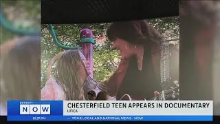 Chesterfield teen featured in documentary on down syndrome