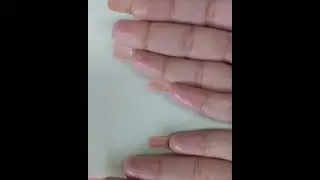 Solutions for sweaty hands