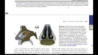 Scott Brown's Rhinology - Outpatient Assessment 