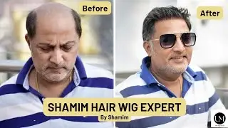 Hair Patches For Men | Men Hair Transformation | Hair wig Expert | Shamim Hair wig Expert | Kolkata