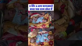 Birth of a two-headed child | #viralvideo #children #adhbhut