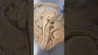 REAL Human Pituitary Gland