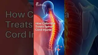 What is the process for spinal cord injury stem cell therapy in Colombia? | PlacidWay Medical Touris