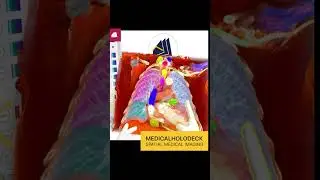Spatial Medical Imaging | Free Download!
