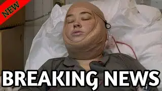 Death of Shannon : 1 hour ago, Mama June Star Shannon Surgery died || Big Sad News!