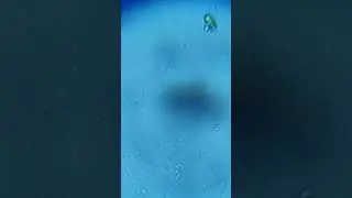 (HD)-Darting motility test vibrio Cholerae rice water stool hanging drop prepration