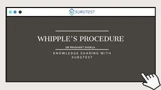 Whipple's Procedure by Dr Prashant Shukla