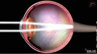 How Human Eyes Work