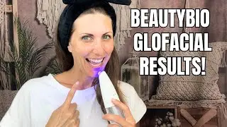 Does This Blue LED Pore Cleaner Really Work? BeautyBio GLOfacial Results!