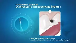Comment utiliser la brossette interdentaire Inava ?