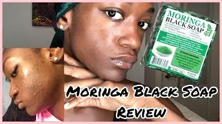 MORINGA AFRICAN BLACK SOAP REVIEW | HOW TO GET RID OF DARK SPOTS FAST