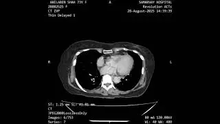 CT UROGRAM