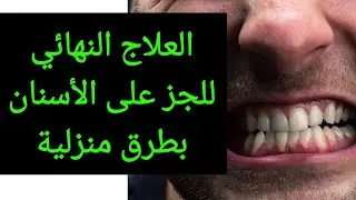 العلاج النهائي للجز على الأسنان بطرق منزلية فعالة جداً مع د/ إيريني أبادير
