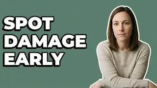 What Are The Red Flags Of RA Joint Damage?