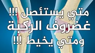 متى استئصل غضروف الركبة ومتى اخيطة؟؟