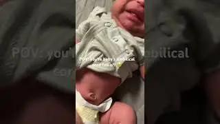 Baby Kaisen&rsquo;s umbilical cord fell off #cutebaby #ohno #baby #babyboy
