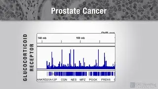 Epigenetic Drivers of Prostate Cancer