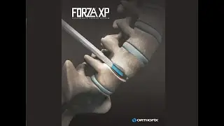Orthofix: FORZA XP Expandable Spacer System
