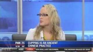 FOX 35 News  Dr. Stephanie Irzyk - What is Cupping?