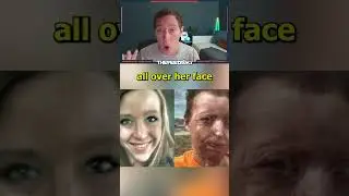 Man Accidentally Sets Wife On Fire