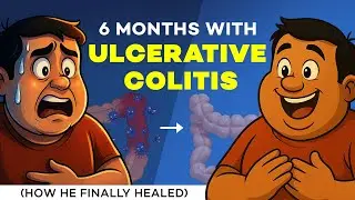 Ulcerative Colitis Cure Story &ndash; Fully Healed Naturally (Part 2)
