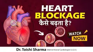 हार्ट ब्लॉकेज कैसे बढ़ता है? | What Is Heart Blockage? | Interventional Cardiologist In Delhi, India