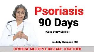 Psoriasis- Case Study - Multi-Language