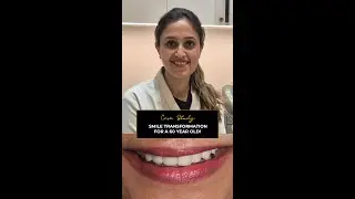 Opal Dental Care Studio |Smile transformation for a 60 year old!