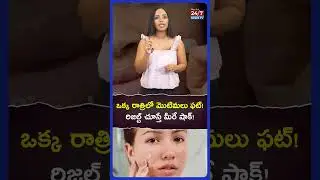 రాత్రికి రాత్రే పింపుల్ మాయం! | Overnight lo Pimple Maayam! 😱 Magic Patch Asalu Pani Chestunda?