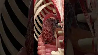 Polycystic Kidney Disease (PKD) | 3D Medical Animation  #anatomy #medicalanimation