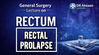 RECTAL PROLAPSE EXPLAINED WITH LECTURE NOTES | General Surgery Lecture | MBBS & USMLE 