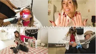 getting multiple tooth gems + tattoo removal & holiday nails! ~vlogmas day 5~