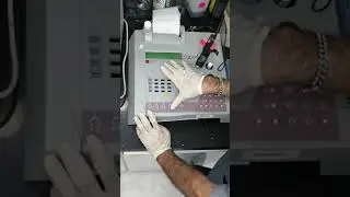 PT /stago diagnostica part 2