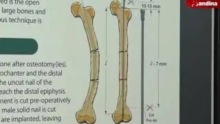 Campaña de Osteogénesis Imperfecta - INSN