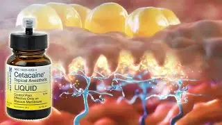 The Science Behind Cetacaine Needle-free Topical Anesthetic
