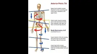 Pelvic Alignment Device - Physical Therapist 10-23-2025