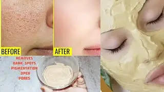 Multani Mitti Remedies for Open Pores | Get Smooth Clear Skin | Clogged pores 